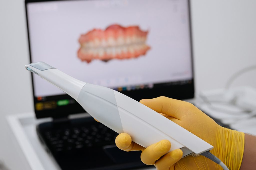 3d intraoral scanner